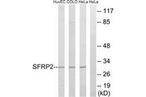 Western blot analysis of extracts from HeLa/COLO/HuvEc cells, using SFRP2 Antibody. (SFRP2 anticorps  (AA 119-168))