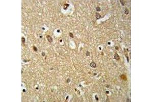 IGF1R antibody IHC analysis in formalin fixed and paraffin embedded brain tissue.