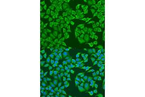 Immunofluorescence analysis of U2OS cells using IGF2BP3 antibody.