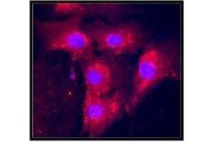 anti-Vascular Endothelial Growth Factor (VEGF) (full length) antibody