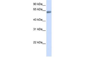 WB Suggested Anti-SLC47A2 Antibody Titration: 0. (SLC47A2 anticorps  (C-Term))