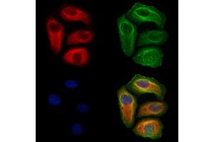 ABIN6265996 and ABIN6273086 staining Hela cells by IF/ICC.