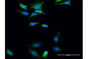 Immunofluorescence of purified MaxPab antibody to UGP2 on HeLa cell.