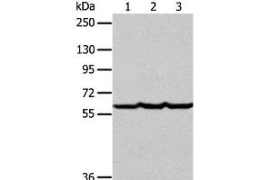 Western Blot analysis of Human liver cancer tissue, hela and Jurkat cell using Factor IX Polyclonal Antibody at dilution of 1:400 (Coagulation Factor IX anticorps)