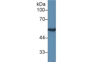 Western blot analysis of Rat Skin lysate, using Human KRT15 Antibody (2 µg/ml) and HRP-conjugated Goat Anti-Rabbit antibody (