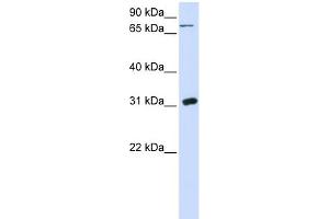 WB Suggested Anti-UPP1 Antibody Titration:  0. (UPP1 anticorps  (N-Term))