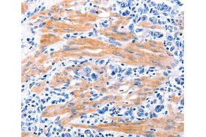 Immunohistochemistry (IHC) image for anti-Growth Differentiation Factor 9 (GDF9) (AA 205-454) antibody (ABIN3016573)