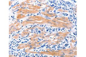 Immunohistochemistry (IHC) image for anti-Growth Differentiation Factor 9 (GDF9) (AA 205-454) antibody (ABIN3016573) (GDF9 anticorps  (AA 205-454))