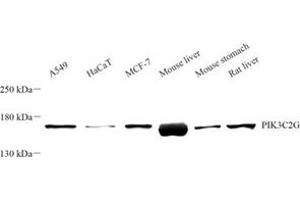 Western blot analysis of PIK3C2G (ABIN7075042) at dilution of 1: 500