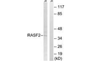 Western blot analysis of extracts from Jurkat cells, using RASSF2 Antibody. (RASSF2 anticorps  (AA 109-158))