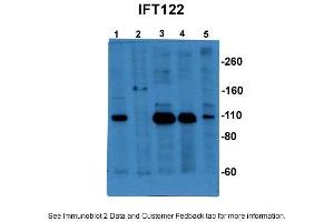 Sample Type: 1. (IFT122 anticorps  (C-Term))