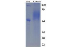 Image no. 3 for Parathyroid Hormone (PTH) peptide (Ovalbumin) (ABIN5666326)