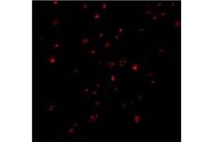 Immunofluorescence of IRE1p in A20 cells with AP30444PU-N IRE1p antibody at 2 ug/ml. (ERN1 anticorps  (C-Term))