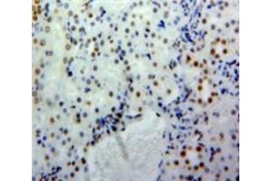 Used in DAB staining on fromalin fixed paraffin-embedded Kidney tissue (SLC9A3R2 anticorps  (AA 56-326))