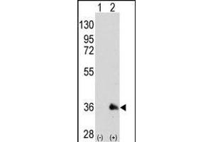 Western blot analysis of SOX2 (arrow) using mouse monoclonal SOX2 antibody (ABIN387798 and ABIN2843854). (SOX2 anticorps)