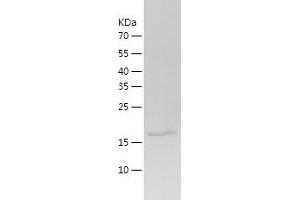 Western Blotting (WB) image for Adrenergic, alpha-2B-, Receptor (ADRA2B) (AA 202-370) protein (His tag) (ABIN7121751)