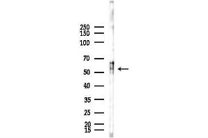 Western blot analysis of lysates from F10-LUC cells(starvation,24h treatment), using TTC23 Antibody at 1/1000 dilution.