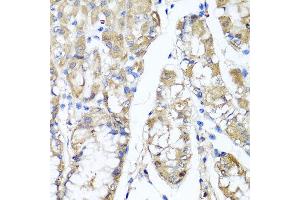 Immunohistochemistry of paraffin-embedded human gastric using TNFAIP6 antibody at dilution of 1:100 (x40 lens).