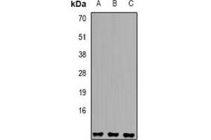 Western blot analysis of Sm E expression in A549 (A), K562 (B), HepG2 (C) whole cell lysates. (SNRPE anticorps)