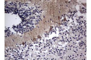 Image no. 3 for anti-Tuberous Sclerosis 1 (TSC1) (AA 836-1164) antibody (ABIN1491686)