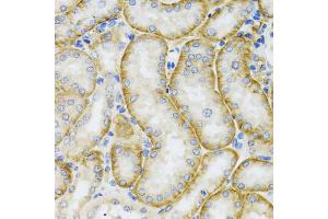 Immunohistochemistry of paraffin-embedded mouse kidney using ARFGAP1 antibody (ABIN5974280) at dilution of 1/100 (40x lens). (ARFGAP1 anticorps)
