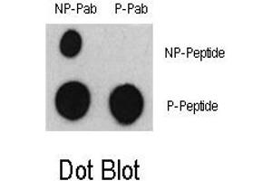 Image no. 1 for anti-Activating Transcription Factor 2 (ATF2) (pSer322) antibody (ABIN358324)
