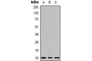 Western blot analysis of Apelin expression in 22RV1 (A), MCF7 (B), mouse brain (C) whole cell lysates. (Apelin anticorps  (C-Term))