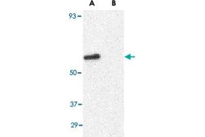 Western blot analysis of GPR44 in Jurkat cell lysate with GPR44 polyclonal antibody  at 1 ug/mL in (A) the absence and (B) presence of blocking peptide. (Prostaglandin D2 Receptor 2 (PTGDR2) (N-Term) anticorps)