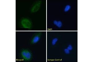 Immunofluorescence staining of fixed U251 cells with anti-BACE2 antibody 1/9  Immunofluorescence analysis of paraformaldehyde fixed U251 cells permeabilized with 0.