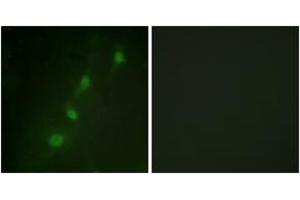 Immunofluorescence analysis of HeLa cells, using SGK (Ab-78) Antibody. (SGK1 anticorps  (AA 41-90))