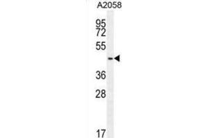 Western Blotting (WB) image for anti-DDB1 and CUL4 Associated Factor 4-Like 2 (DCAF4L2) antibody (ABIN2995734)