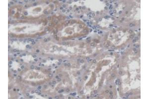 DAB staining on IHC-P; Samples: Human Kidney Tissue