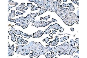 IHC analysis of CCR2 using anti-CCR2 antibody (ABIN7602136).