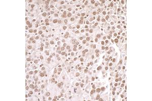 Immunohistochemistry (IHC) image for anti-Protein Arginine Methyltransferase 1 (PRMT1) (AA 1-50) antibody (ABIN7453933) (PRMT1 anticorps  (AA 1-50))