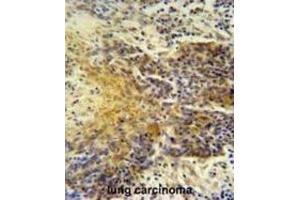 Immunohistochemistry (IHC) image for anti-Mitochondrial Ribosomal Protein S24 (MRPS24) antibody (ABIN2995673)