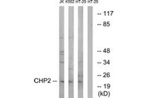 Western blot analysis of extracts from HT-29/K562/Jurkat cells, using CHP2 Antibody. (Chp2 anticorps  (AA 101-150))