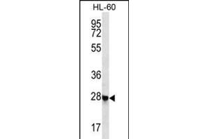 C Antibody (N-term) (ABIN656356 and ABIN2845654) western blot analysis in HL-60 cell line lysates (35 μg/lane). (Chromosome 12 Open Reading Frame 52 (C12orf52) (AA 44-72), (N-Term) anticorps)
