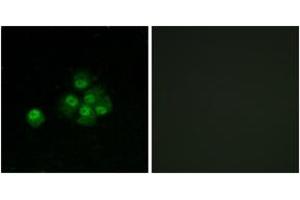 Immunofluorescence (IF) image for anti-Insulin Receptor Substrate 1 (IRS1) (pSer636) antibody (ABIN2888449) (IRS1 anticorps  (pSer636))