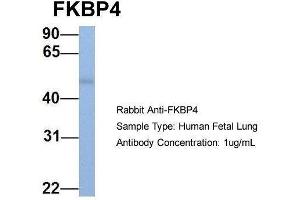 Host:  Rabbit  Target Name:  FKBP4  Sample Type:  Human Fetal Lung  Antibody Dilution:  1. (FKBP4 anticorps  (C-Term))