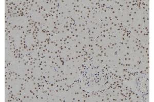 ABIN6257812 and ABIN6273635 at 1/100 staining Rat kidney tissue by IHC-P.
