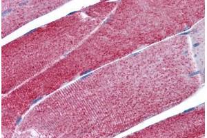 Human Skeletal muscle: Formalin-Fixed, Paraffin-Embedded (FFPE)