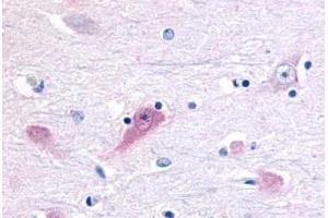 Anti-ROR Beta antibody  ABIN1049295 IHC staining of human brain, thalamus. (RORB anticorps  (Ligand Binding Domain))