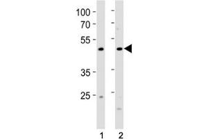 FOXA2 antibody western blot analysis in (1) human MCF-7 cell line and (2) rat stomach tissue lysate.