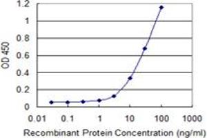 Detection limit for recombinant GST tagged RAB28 is 1 ng/ml as a capture antibody.
