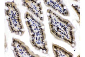 CRM1 was detected in paraffin-embedded sections of mouse intestine tissues using rabbit anti- CRM1 Antigen Affinity purified polyclonal antibody (Catalog # ) at 1 µg/mL.