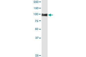 PLOD2 MaxPab rabbit polyclonal antibody. (PLOD2 anticorps  (AA 1-758))