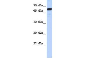 WB Suggested Anti-ZNF221 Antibody Titration:  0. (ZNF221 anticorps  (N-Term))
