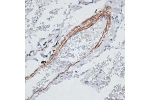 Immunohistochemistry of paraffin-embedded human lung using Tropomyosin 1 antibody (ABIN3021577, ABIN3021578, ABIN3021579, ABIN1513635 and ABIN6215262) at dilution of 1:100 (40x lens).