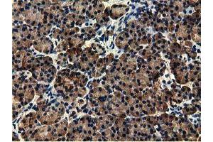 Immunohistochemical staining of paraffin-embedded Human Kidney tissue using anti-EPHX2 mouse monoclonal antibody. (EPHX2 anticorps)