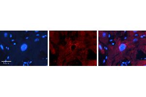 Rabbit Anti-MBD2 Antibody   Formalin Fixed Paraffin Embedded Tissue: Human heart Tissue Observed Staining: Nucleus Primary Antibody Concentration: 1:100 Other Working Concentrations: N/A Secondary Antibody: Donkey anti-Rabbit-Cy3 Secondary Antibody Concentration: 1:200 Magnification: 20X Exposure Time: 0. (MBD2 anticorps  (Middle Region))